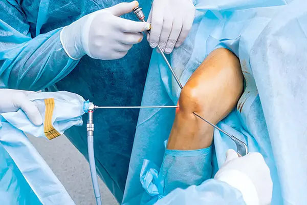 Arthroscopic and sport Surgeries - Dr Issam Mardini
