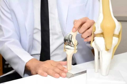 Joint replacements of hip knees and shoulders replacement and revision