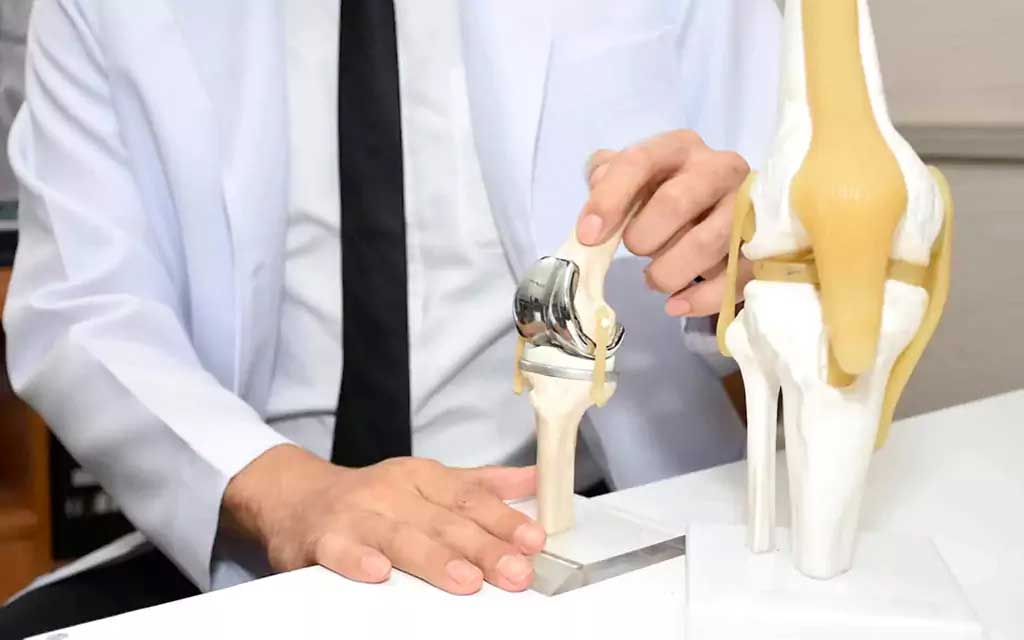 Joint replacements of hip knees and shoulders replacement and revision