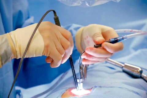 Minimal invasive and microscopic surgery